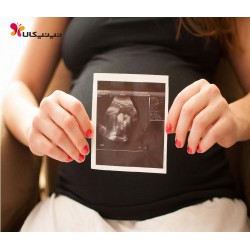 هفته چهارم بارداری