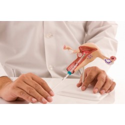 بارداری خارج از رحم و راه های درمان آن