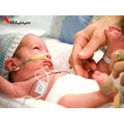 زایمان زودرس و راه های درمان آن