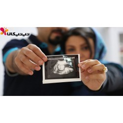 تست غربالگری و نقص های جنین