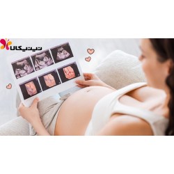 سونوگرافی آنامولی و بهترین زمان انجام آن