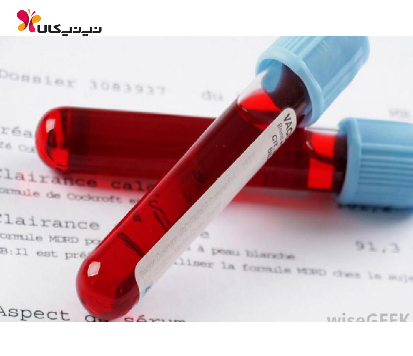 هفته چهارم بارداری